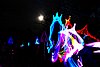 acl.JPG